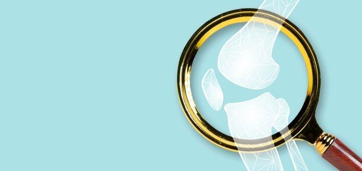 The Impact of Obesity on Joint Health: Effective Strategies to Protect Your Joints