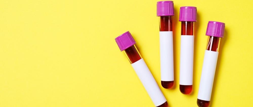 Essential Tips for Preparing for Your Blood Test: A Complete Guide
