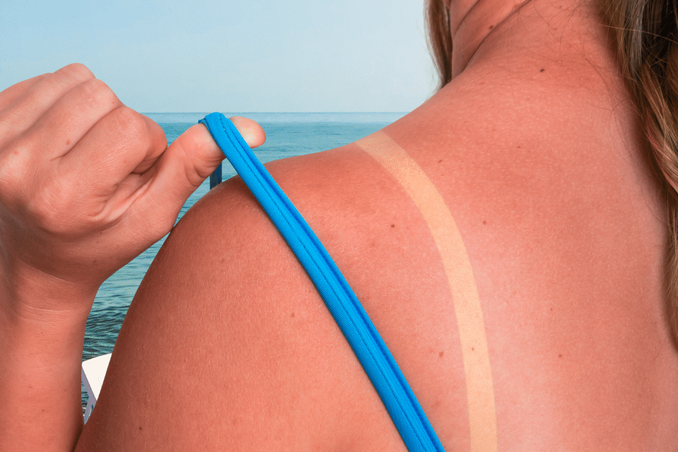 Essential Tips for Safe Medication Use During Summer: Protect Yourself from Sun and Heat Exposure
