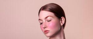 Top Rosacea Triggers to Avoid for Flawless Skin: Essential Tips and Strategies