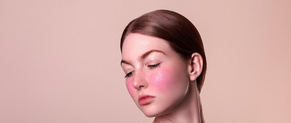 Top Rosacea Triggers to Avoid for Flawless Skin: Essential Tips and Strategies